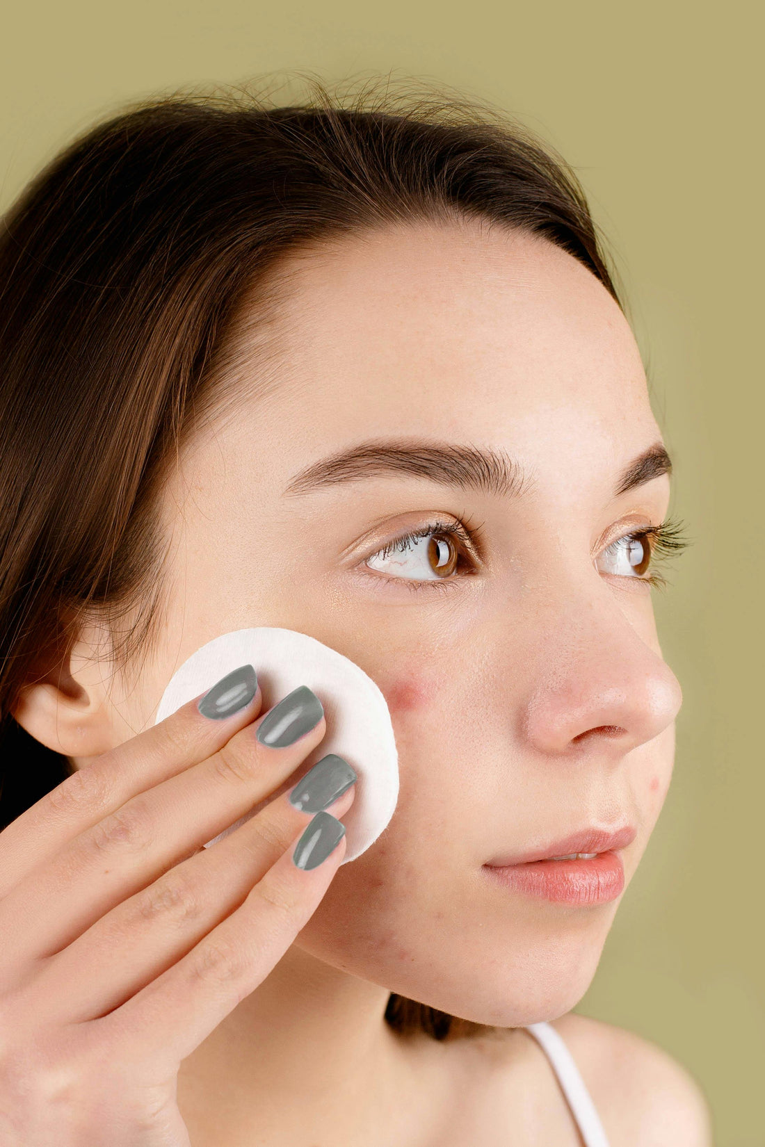 Korean skincare bij acne: eenvoudige routine voor een rustige huid.
