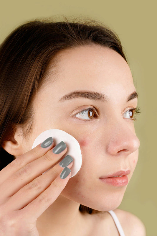 Korean skincare bij acne: eenvoudige routine voor een rustige huid.
